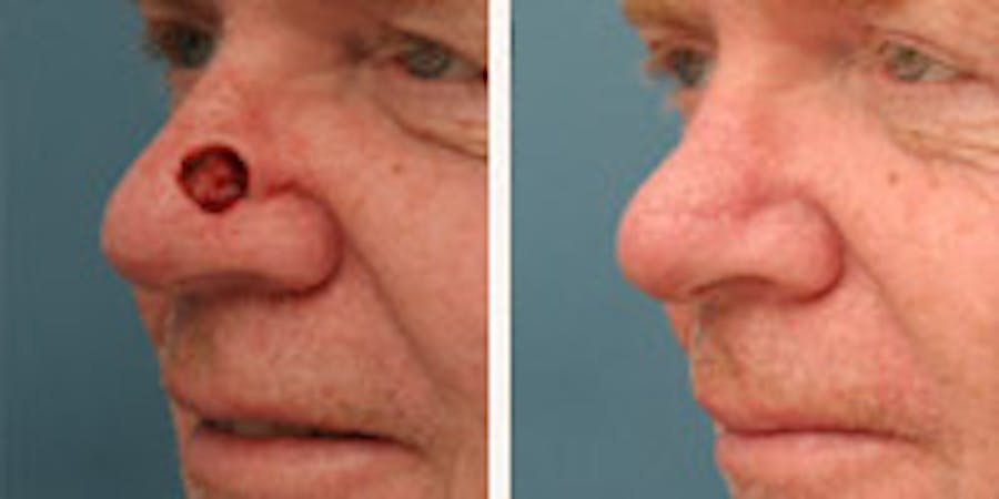 Before and after photos of patient