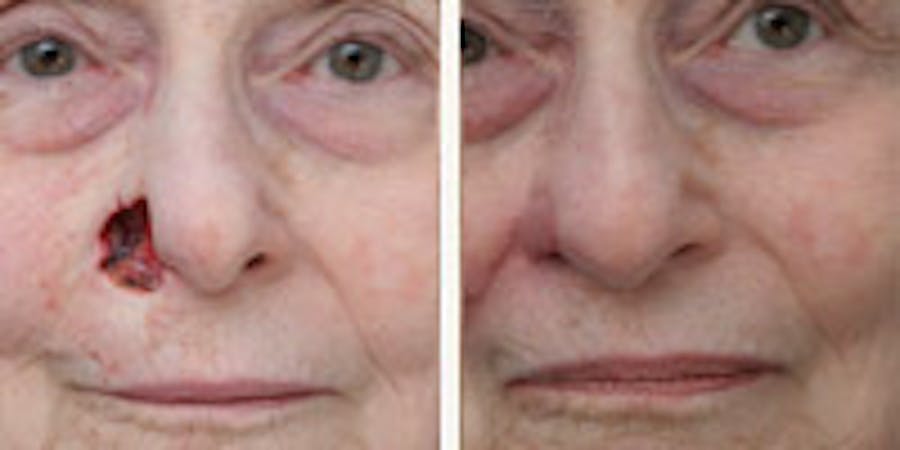 Before and after photos of patient
