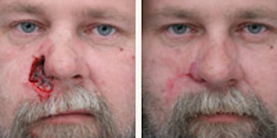 Before and after photos of patient