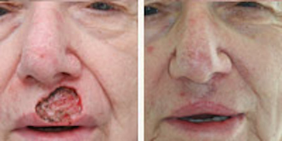 Before and after photos of patient