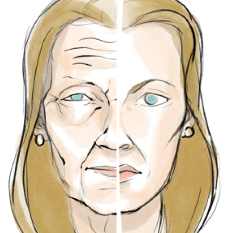 Facelift media