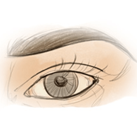 Blepharoplasty media