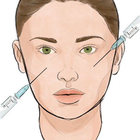 Fillers media