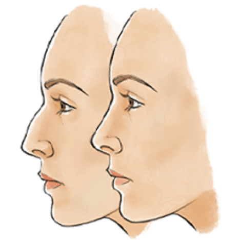 Before And After media