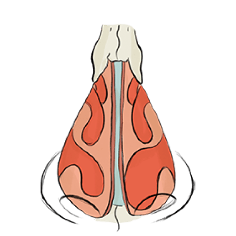 Turbinate Reduction media