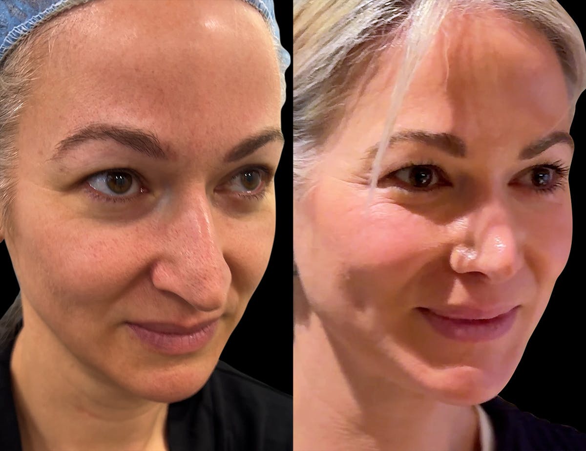 Before & Afters Before & After Gallery - Patient 805679 - Image 1