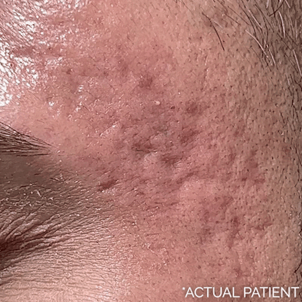 Gifs Before & After Gallery - Patient 420266 - Image 1