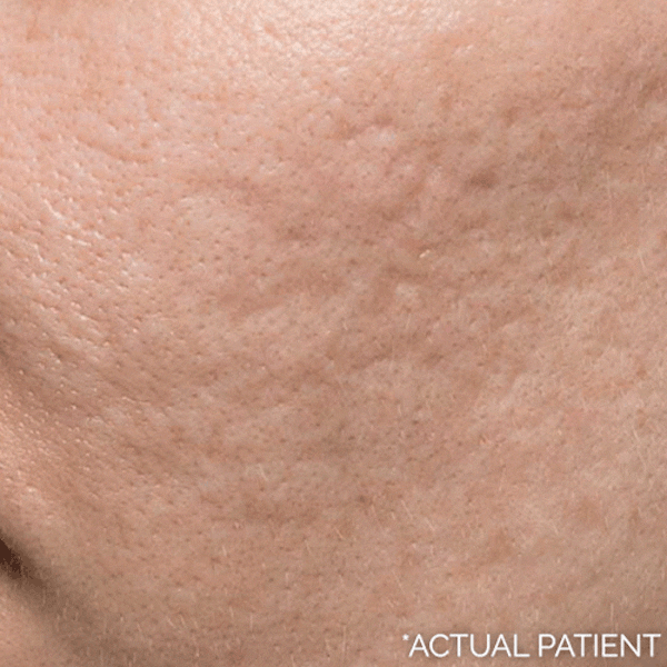 Gifs Before & After Gallery - Patient 177114 - Image 1