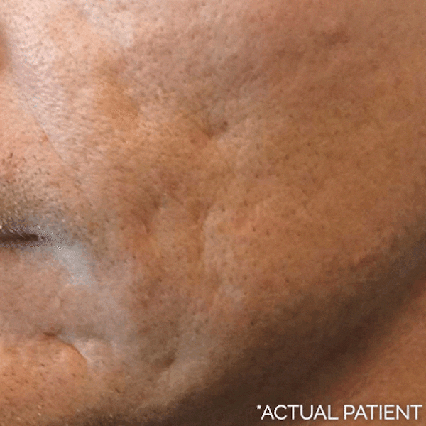 Gifs Before & After Gallery - Patient 401458 - Image 1