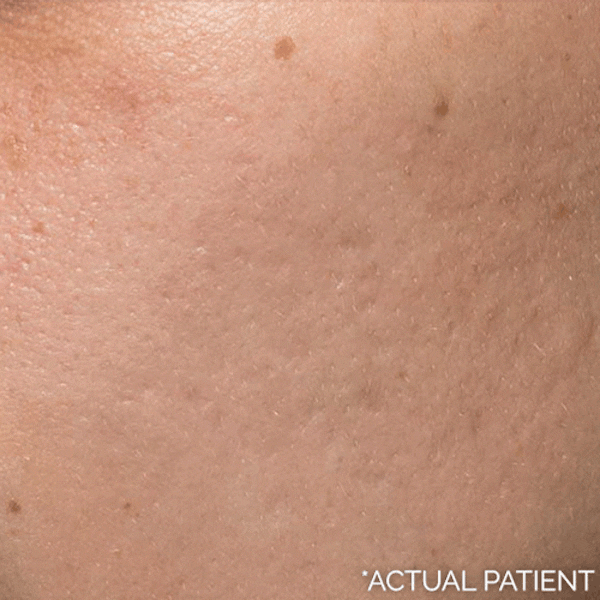 Gifs Before & After Gallery - Patient 631516 - Image 1