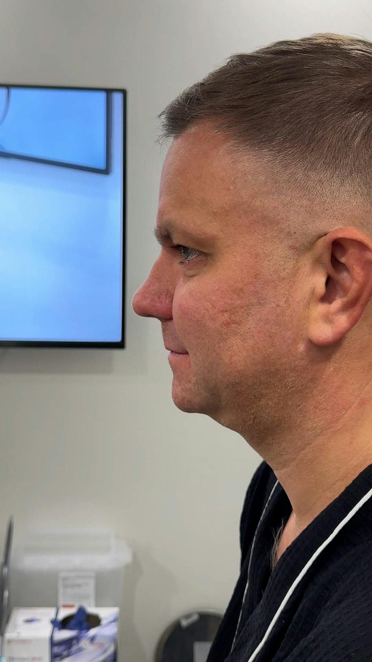 1 Week After Before & After Gallery - Patient 425757 - Image 1