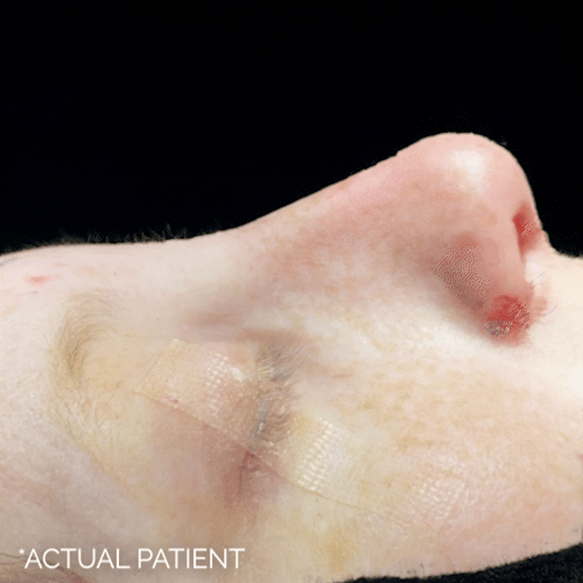 Intraop Before & After Gallery - Patient 204964 - Image 1