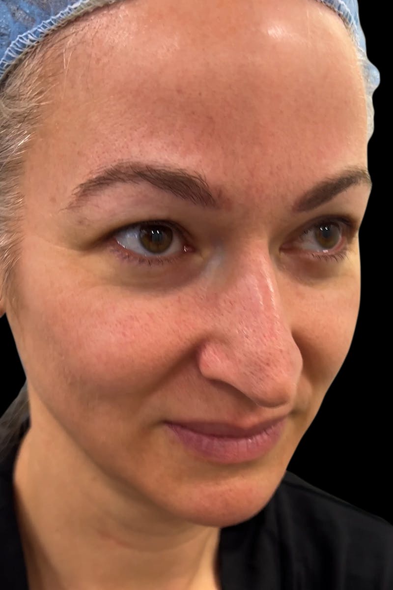 Before & Afters Before & After Gallery - Patient 400145 - Image 3