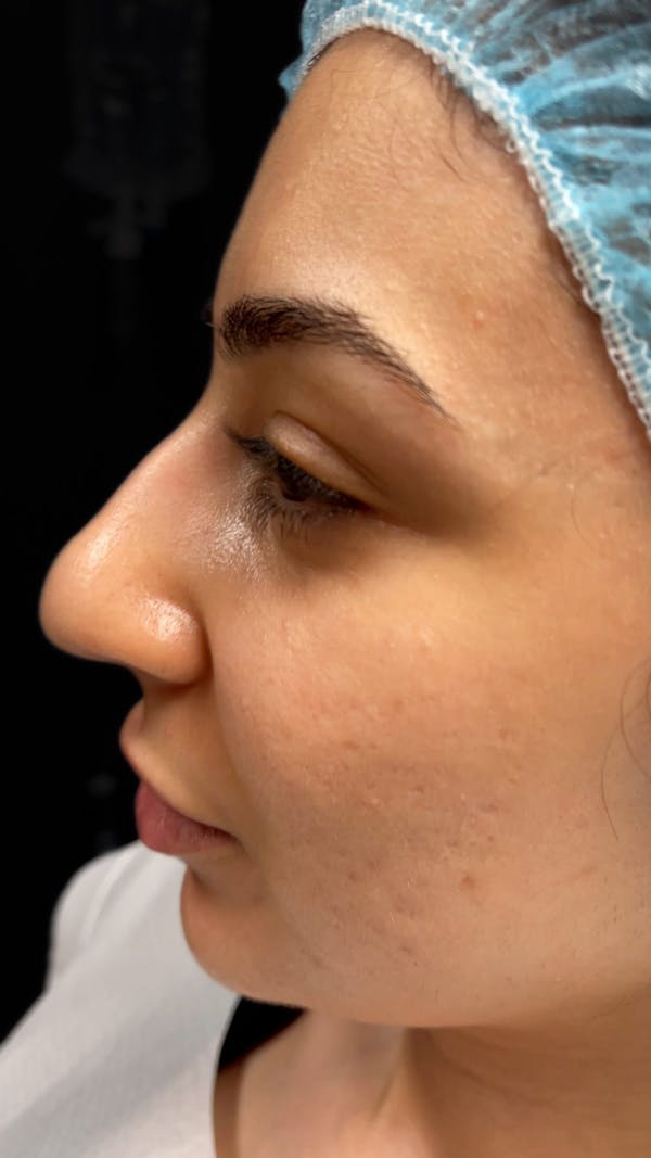Before & Afters Before & After Gallery - Patient 404317 - Image 1
