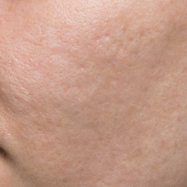 Before & Afters Before & After Gallery - Patient 103610 - Image 2