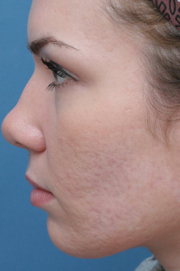 Before & Afters Before & After Gallery - Patient 226993 - Image 1