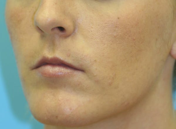 Before & Afters Before & After Gallery - Patient 311961 - Image 1