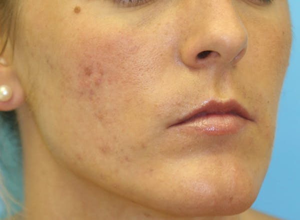 Before & Afters Before & After Gallery - Patient 360588 - Image 1