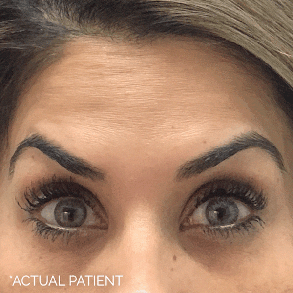 GIFs Before & After Gallery - Patient 232493 - Image 1