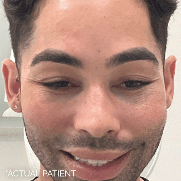 GIFs Before & After Gallery - Patient 257148 - Image 1