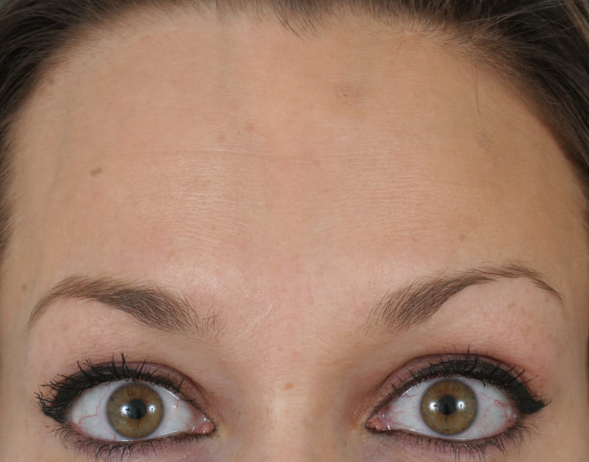 Before & Afters Before & After Gallery - Patient 289472 - Image 1