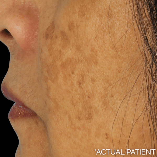 GIFs Before & After Gallery - Patient 173622 - Image 1