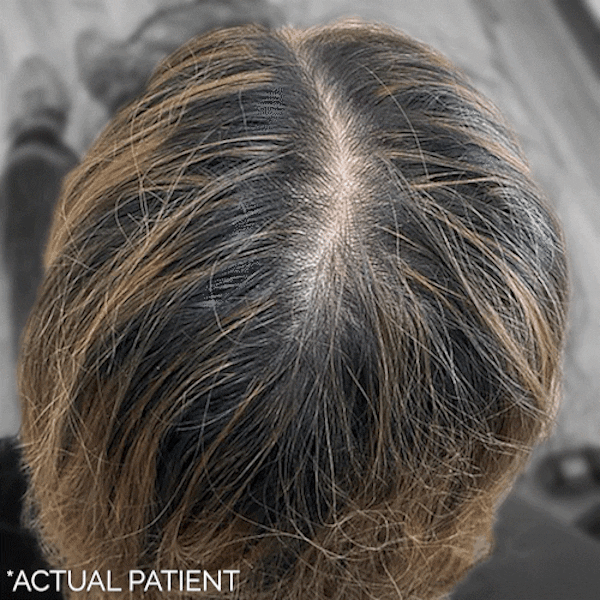 GIFs Before & After Gallery - Patient 310127 - Image 1