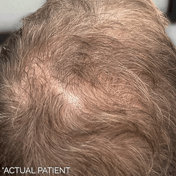 GIFs Before & After Gallery - Patient 427261 - Image 1