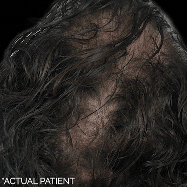 GIFs Before & After Gallery - Patient 232513 - Image 1