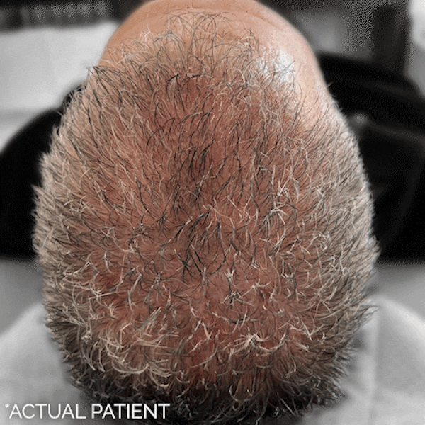 GIFs Before & After Gallery - Patient 360456 - Image 1