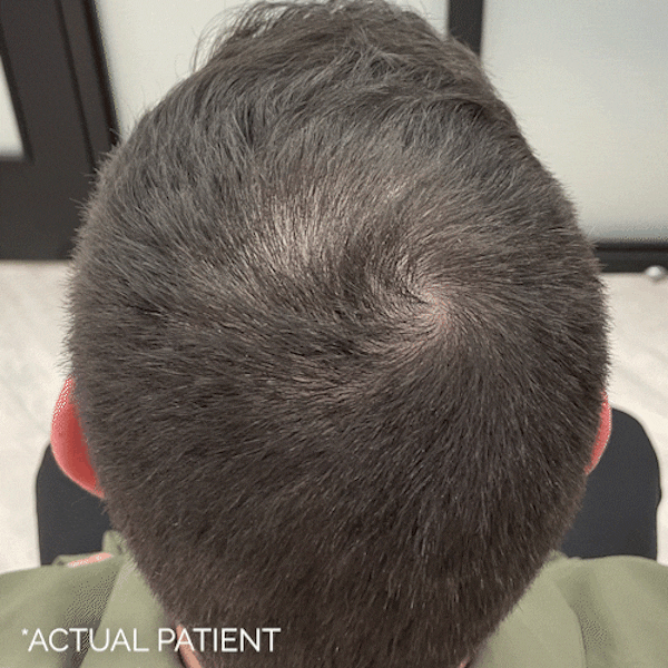 GIFs Before & After Gallery - Patient 146935 - Image 1