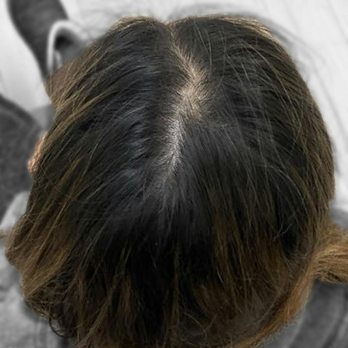 Before & Afters Before & After Gallery - Patient 181707 - Image 1