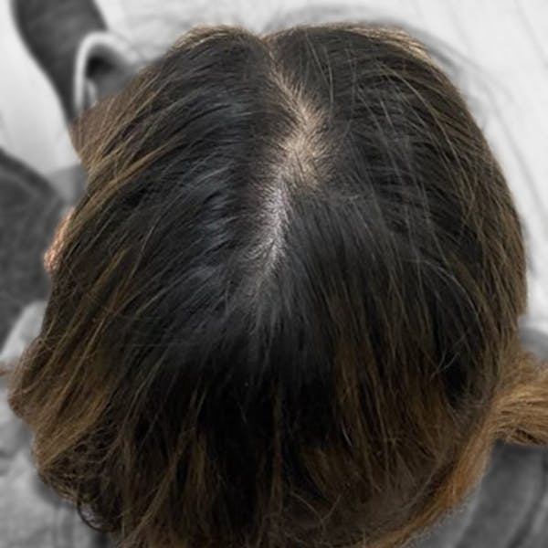 Before & Afters Before & After Gallery - Patient 181707 - Image 1
