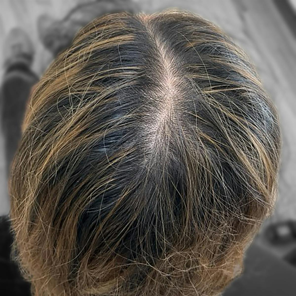 Before & Afters Before & After Gallery - Patient 181707 - Image 2