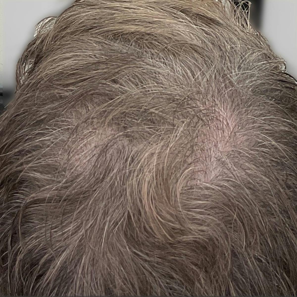 Before & Afters Before & After Gallery - Patient 334353 - Image 1