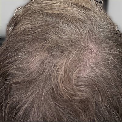 Before & Afters Before & After Gallery - Patient 334353 - Image 1