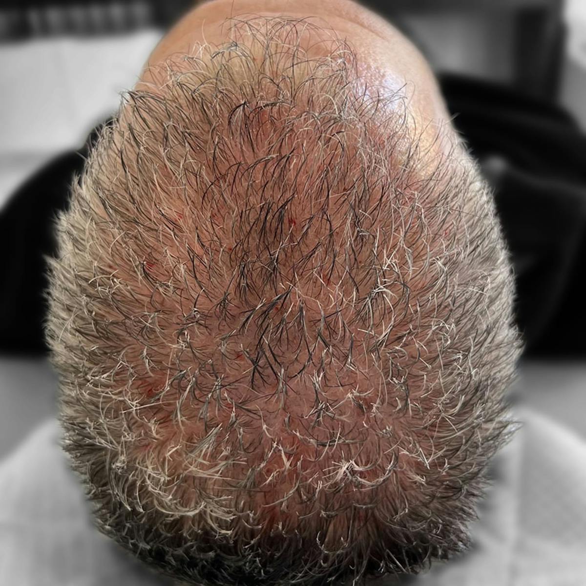 Before & Afters Before & After Gallery - Patient 264391 - Image 2