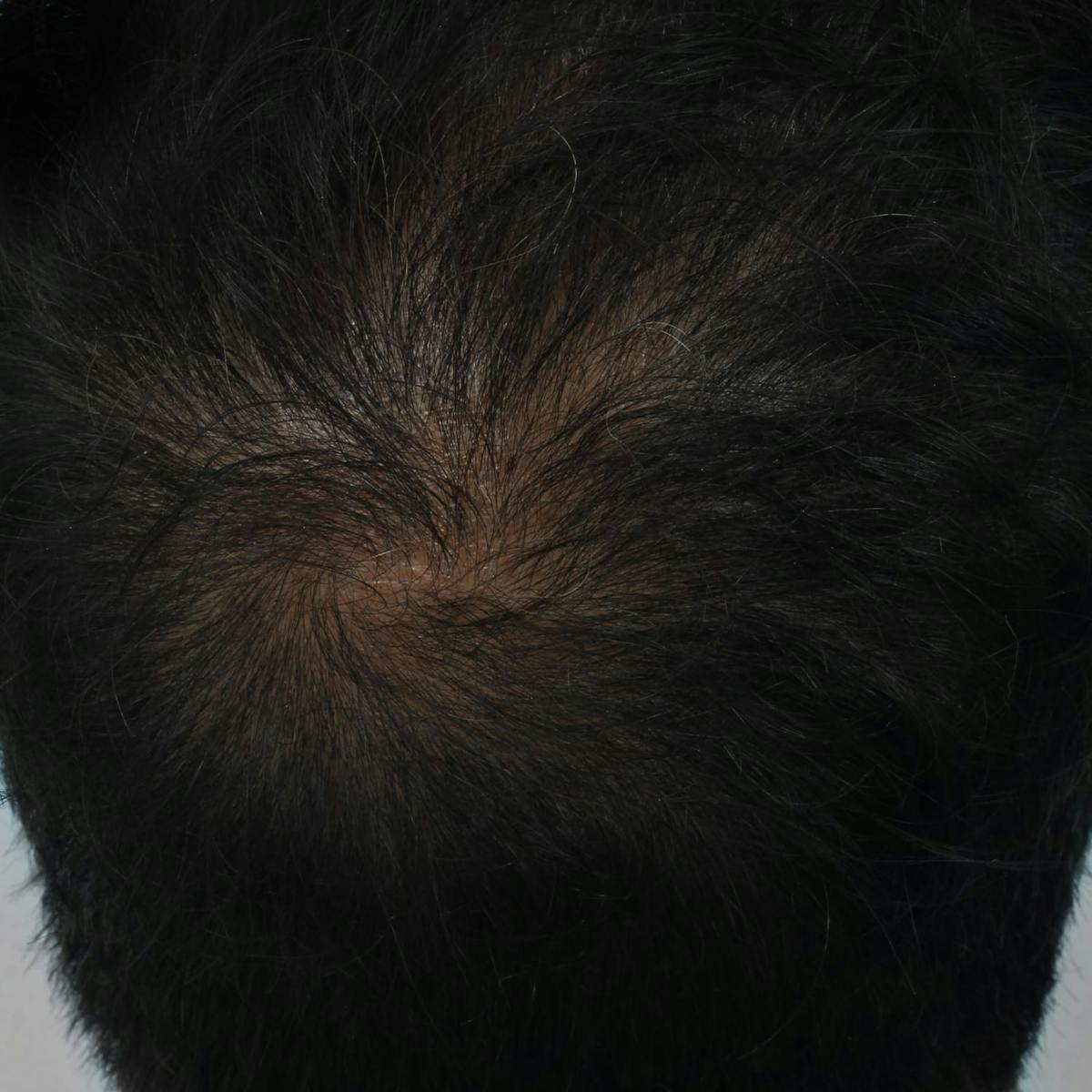 Before & Afters Before & After Gallery - Patient 263481 - Image 1