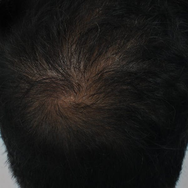 Before & Afters Before & After Gallery - Patient 263481 - Image 1