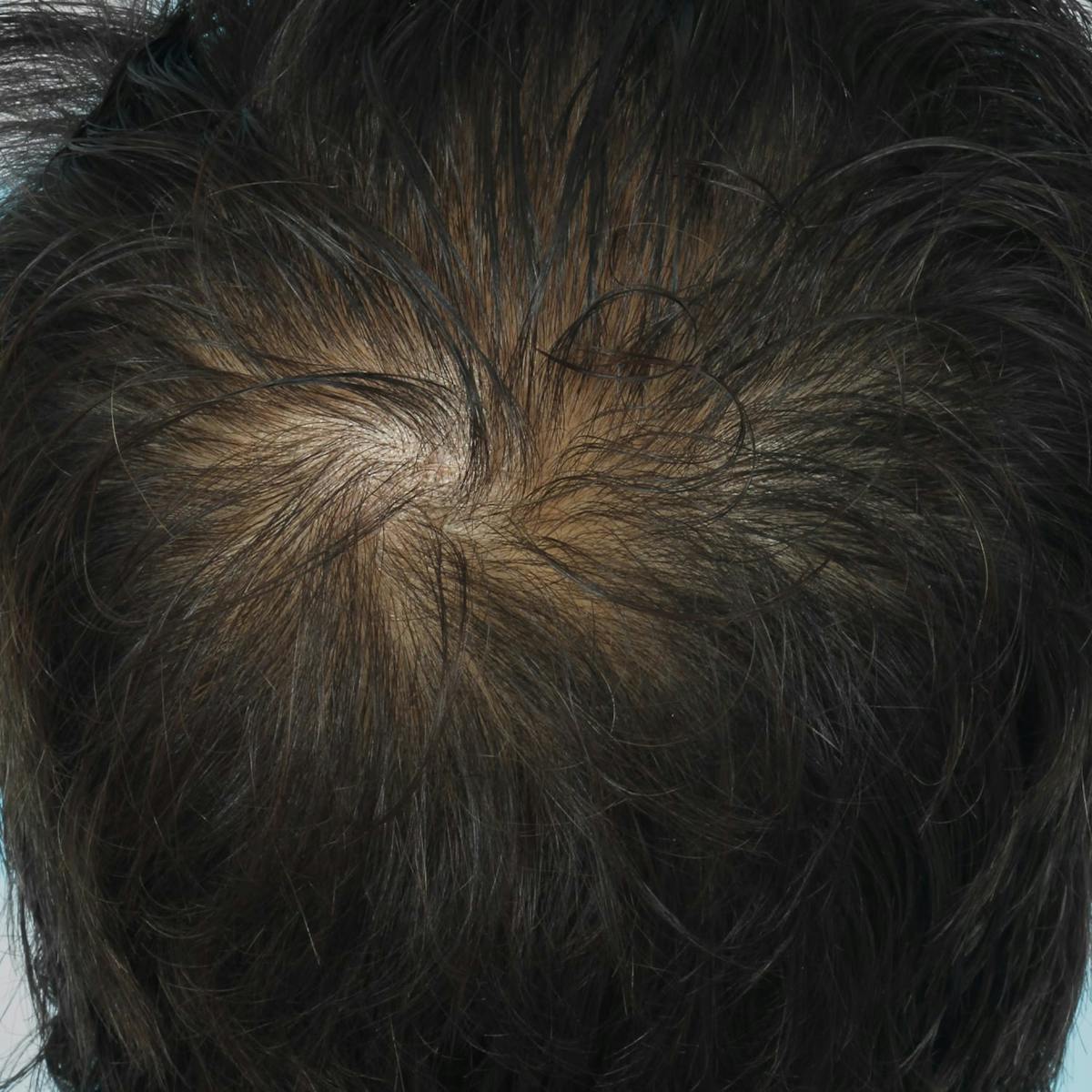 Before & Afters Before & After Gallery - Patient 263481 - Image 2