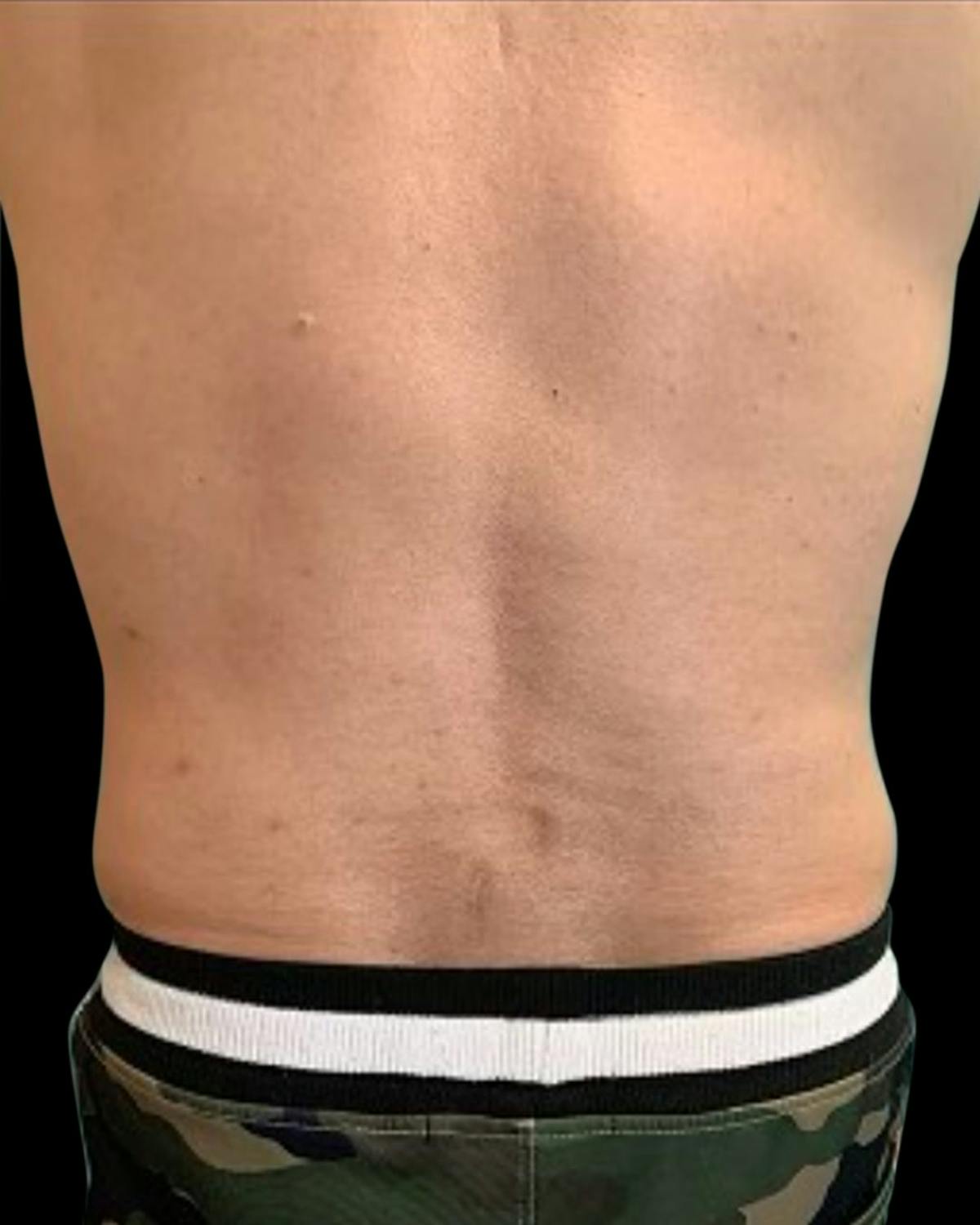 Before & Afters Before & After Gallery - Patient 925557 - Image 1