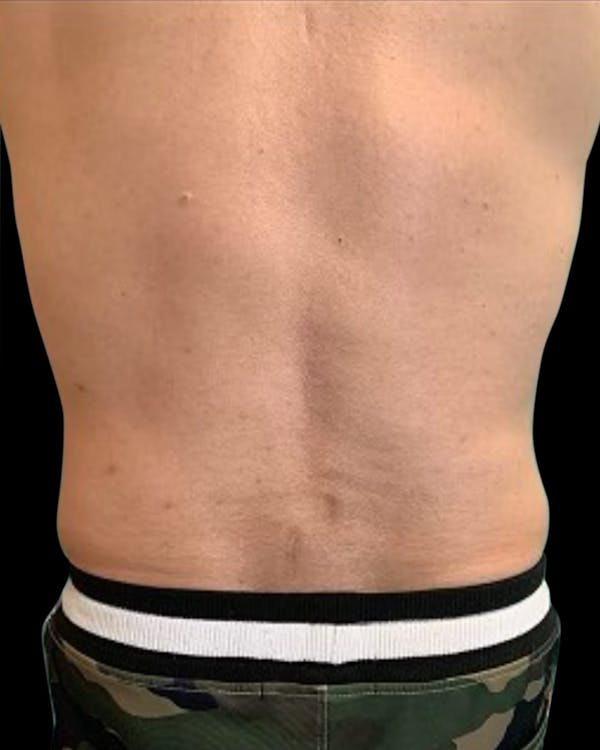 Before & Afters Before & After Gallery - Patient 925557 - Image 1