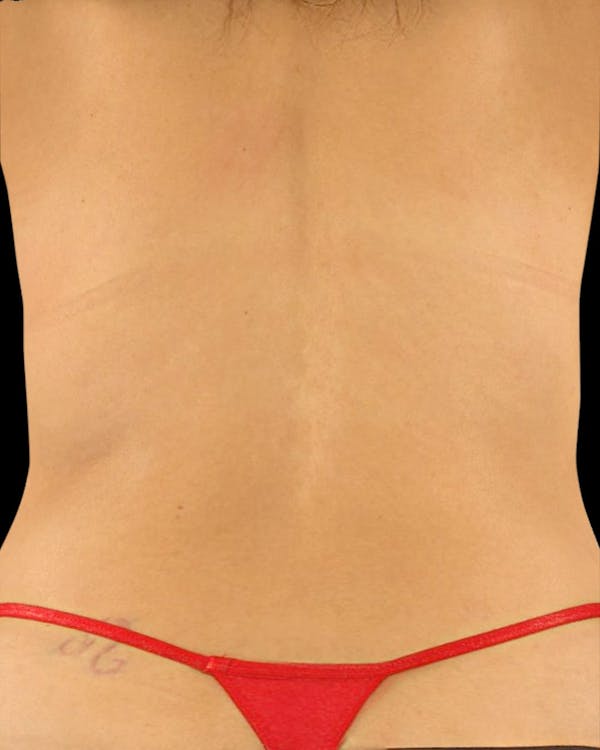 Before & Afters Before & After Gallery - Patient 283003 - Image 1