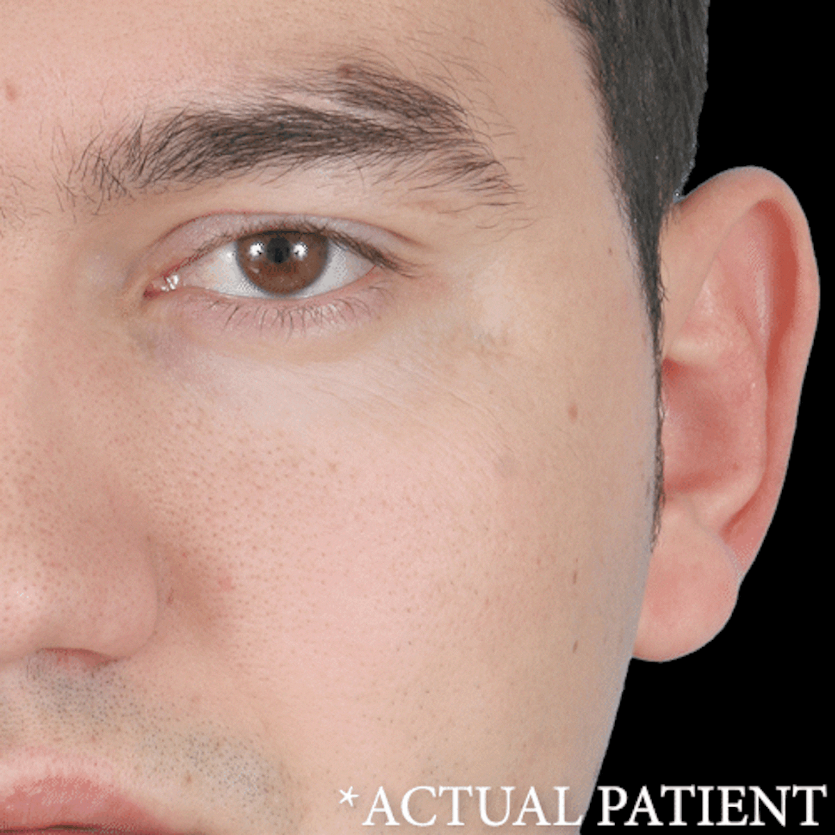 GIFs Before & After Gallery - Patient 228814 - Image 1