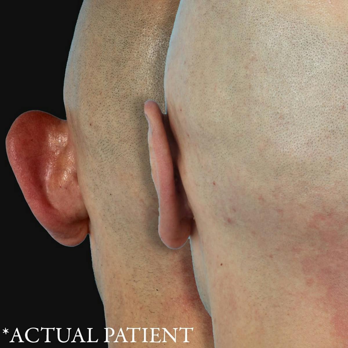 Before & Afters Before & After Gallery - Patient 347046 - Image 1
