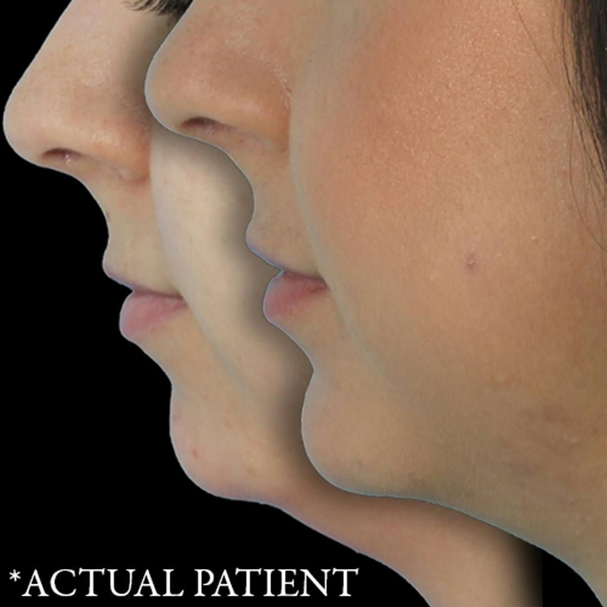 Before & Afters Before & After Gallery - Patient 138007 - Image 1
