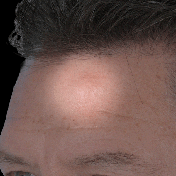 GIFs Before & After Gallery - Patient 746303 - Image 1