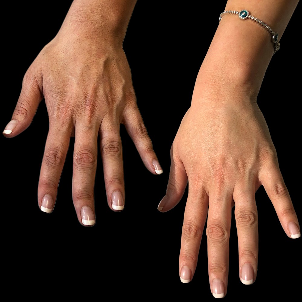 Close up of hands
