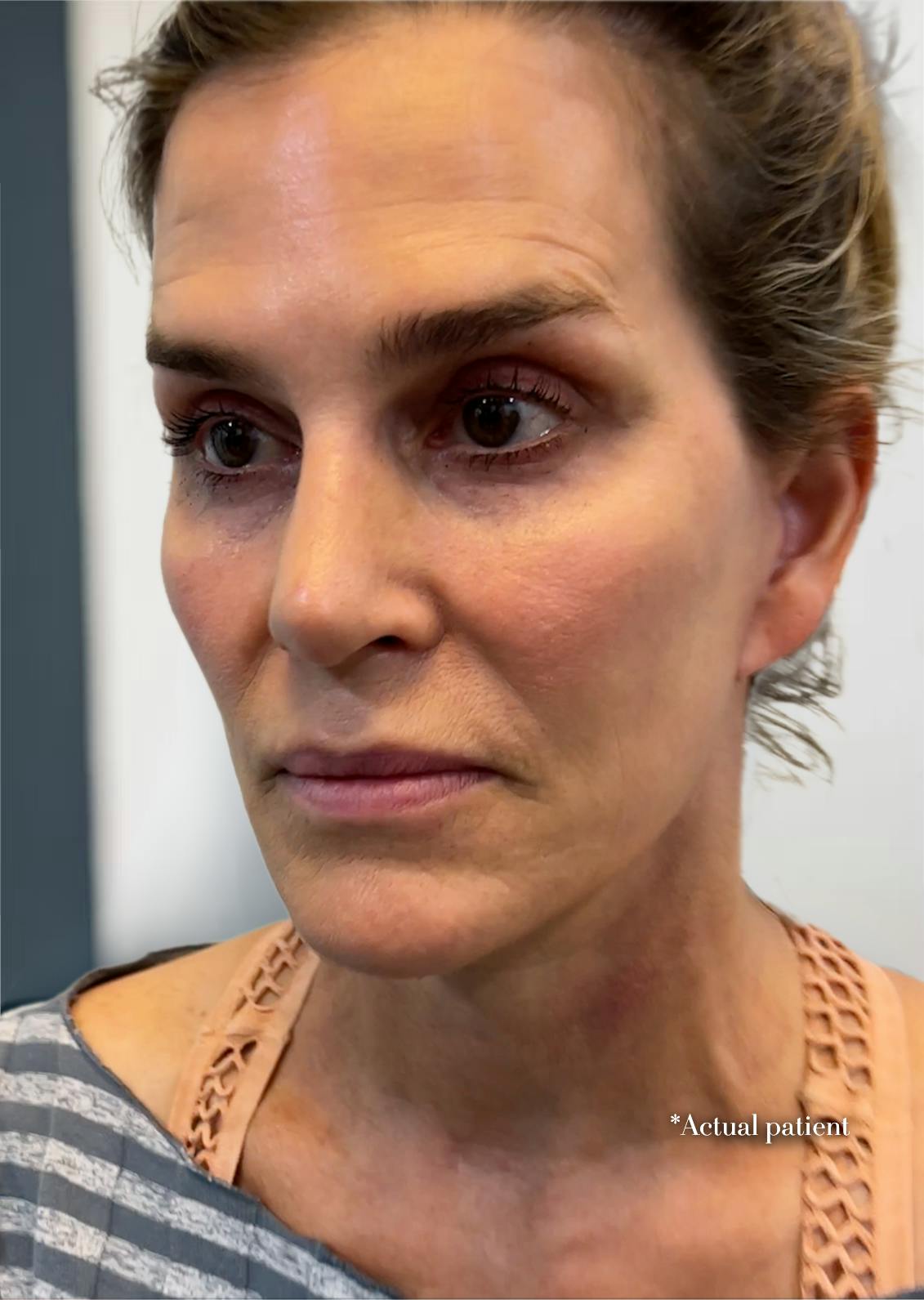 close-up of patient's face