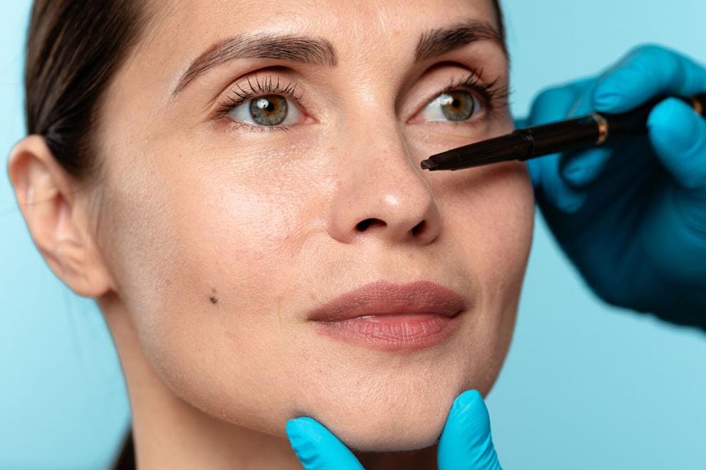 The Luxury of a Nose Job No One Notices